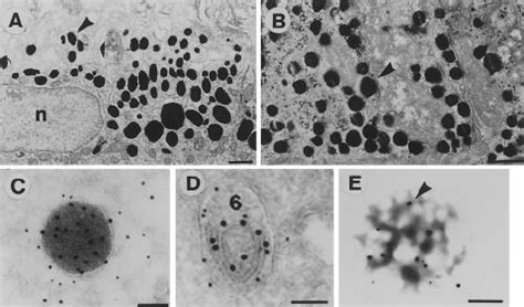 Lysosomes Electron Micrograph