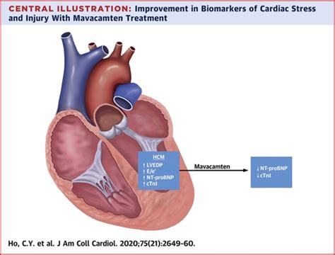 Evaluation of Mavacamten in Symptomatic Patients With Nonobstructive Hypertrophic Cardiomyopathy ...