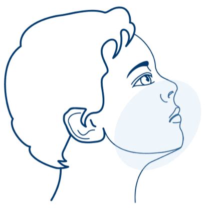 Pediatric Patients With Chronic Sialorrhea | XEOMIN®