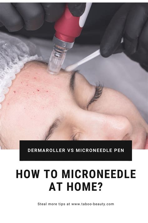 All you need to know about micro-needling at home. There are many benefits of microneedling the ...