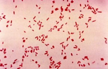 What is the role of Gram stain in the diagnosis of Escherichia coli (E coli) infections?