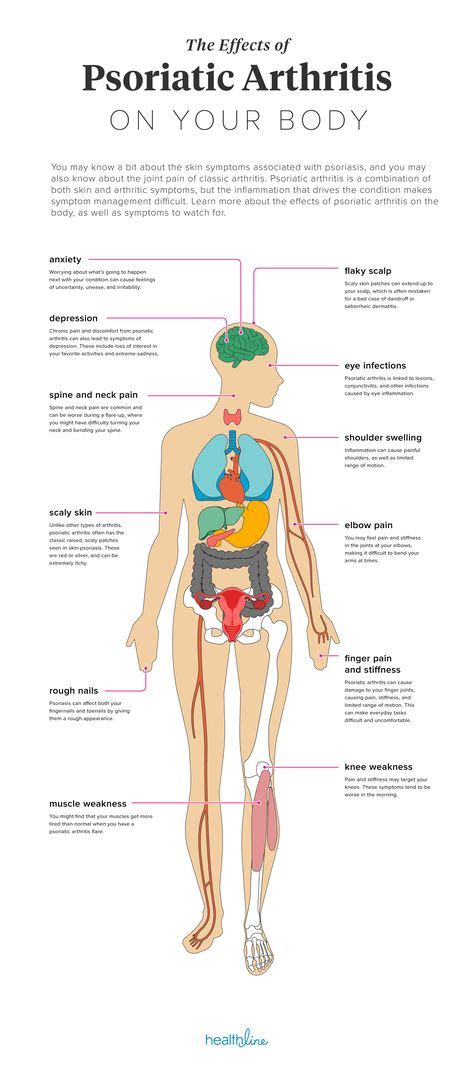 75 Psoriasis ideas in 2021 | psoriasis, psoriatic, psoriatic arthritis