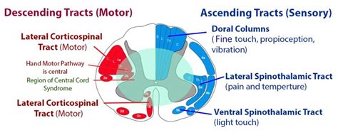 Incomplete Spinal Cord Injuries - Spine - Orthobullets