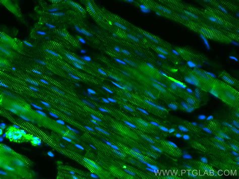 Alpha Actinin antibody (CL488-11313) | Proteintech