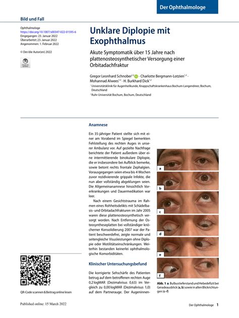 (PDF) Unklare Diplopie mit ExophthalmusUnclear diplopia with exophthalmia: Akute Symptomatik ...