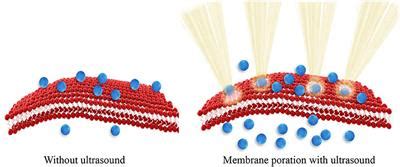 Frontiers | Nano-Enhanced Drug Delivery and Therapeutic Ultrasound for Cancer Treatment and Beyond