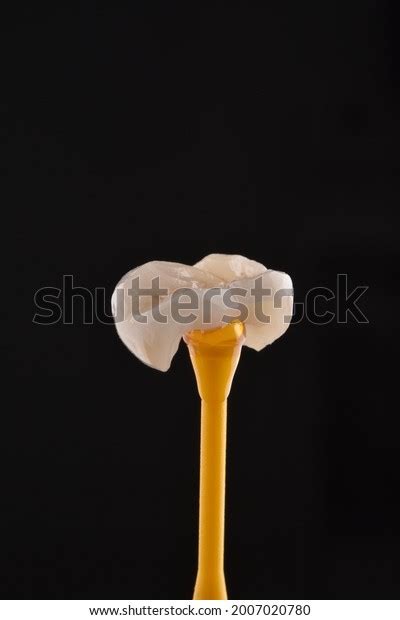 862 Dental Onlays Images, Stock Photos & Vectors | Shutterstock