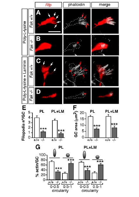 Growth cone shape and actin cytoskeleton organization are impaired in... | Download Scientific ...