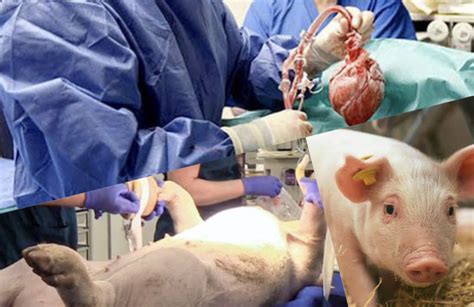 U.S. doctors perform pig-to-human heart transplants