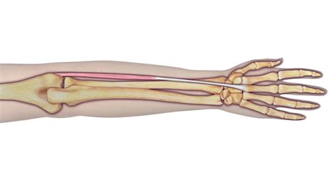 Muscle Test and Tendon Exam: Extensor Carpi Radialis Brevis (ECRB) | Hand Surgery Resource