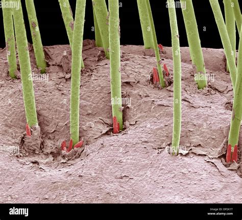 Demodex Eyelash Mites