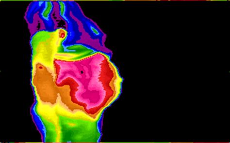 Thermology Software - Infrared Thermal Imaging