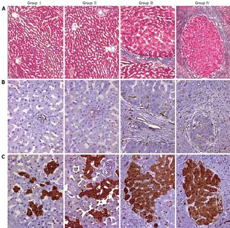 Thrombospondin-1 expression correlates with angiogenesis in ...