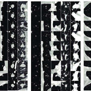 An overview of the proposed CAD system. (a) An example of extracted 2-D ...