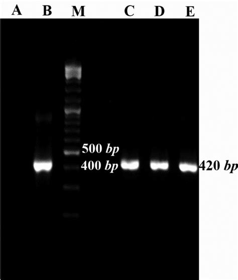 Colony-PCR results for growing colonies using Mtb32C specific primers ...