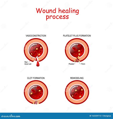 Phases of the Wound Healing Process. Poster with Capillary, Red Blood ...