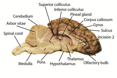 Pig Brain Dissection Internal Features Review Quiz - Quizizz