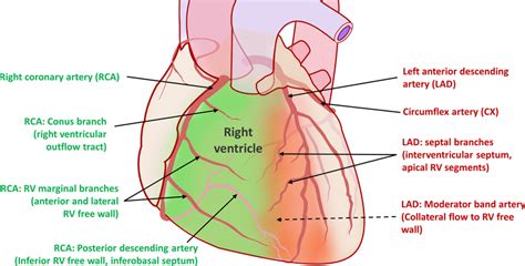 Coronary blood supply to the right ventricle (RV). In the most common... | Download Scientific ...