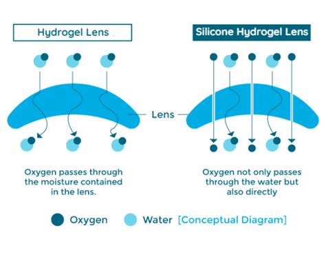 Contact Lenses Buying Guide - Spexmaster