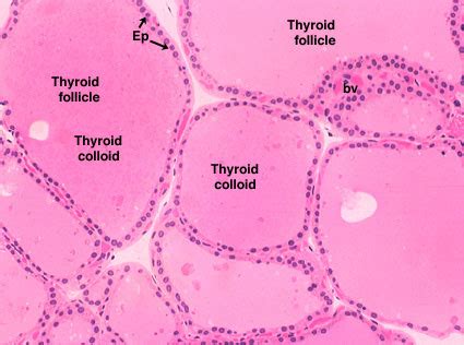 Blood Tissue Slide Labeled