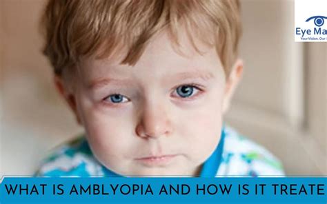 What is Amblyopia and how it is treated? Symptoms, Causes