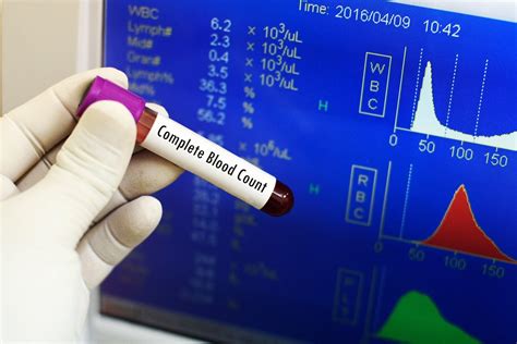 Understanding Blood Counts in Leukemia with Complete Blood Count Test