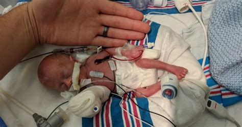 ‘Miracle Baby’: One of the smallest premature infants ever heads home