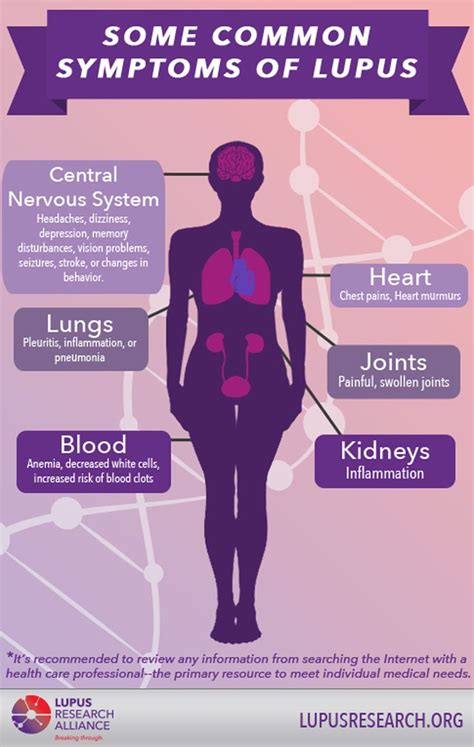 Best 130 Lupus Infographics ideas on Pinterest | Info graphics ...