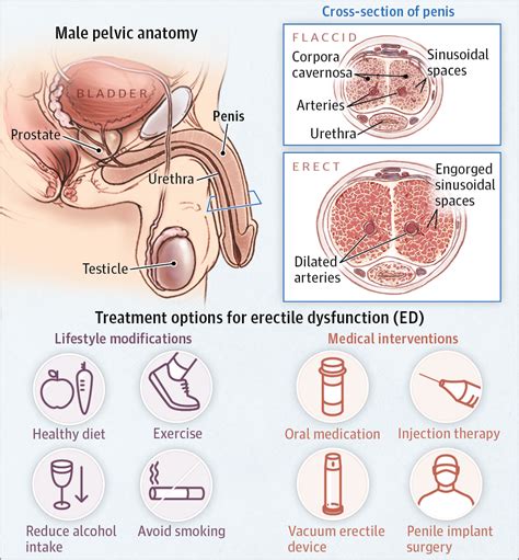 Erectile Dysfunction | Urology | JAMA | The JAMA Network