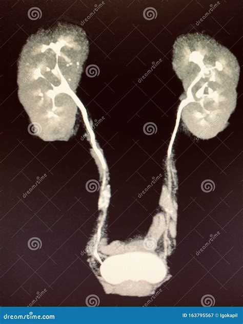 Modern Ct Urogram With Contrast Function Kidneyes Stock Image - Image ...