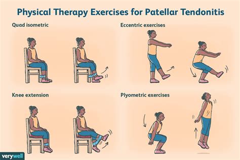 Quadriceps Tendinitis Tendinopathy Exercises Patellar Tendinitis ...