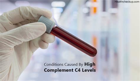 What Does A High Complement C4 Test Mean? | Conditions Caused By Dr ...