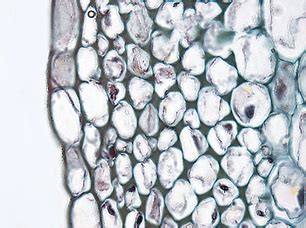 Collenchyma Tissue | Plant and Animal Tissues