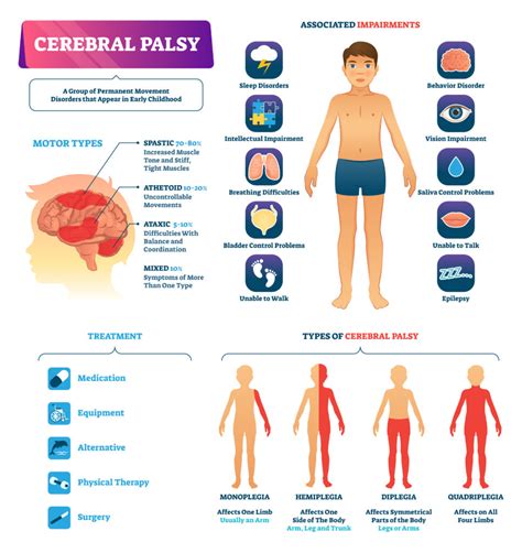 An Overview of the Types of Cerebral Palsy - Birth Injury Guide