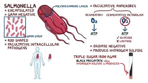 Salmonella typhi (typhoid fever) - Osmosis