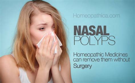 Nasal Polyps - 6 Best Homeopathic medicines for removing them ...