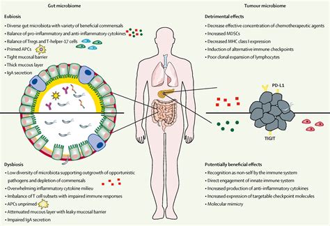 Modulating the microbiome to improve therapeutic response in cancer - The Lancet Oncology