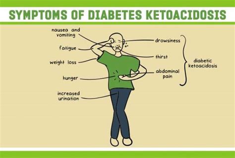 Diabetes Ketoacidosis (DKA) - Causes, Symptoms & Treatment