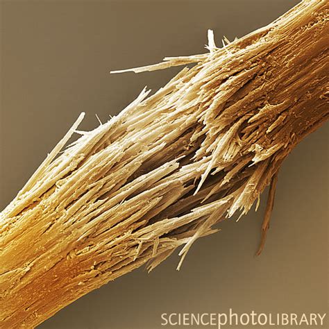 Hair - A microscopic view - Natural Nigerian