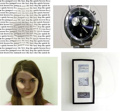 A patient's view of central serous retinopathy | The BMJ