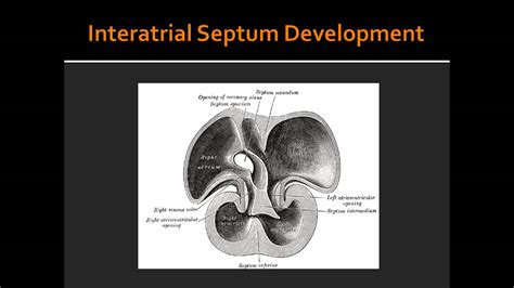 Interatrial Septum Development - YouTube