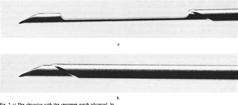 Figure 2 from Percutaneous Needle Biopsy | Semantic Scholar