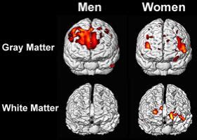 Sex-related variation in human behavior and the brain « LaNCE