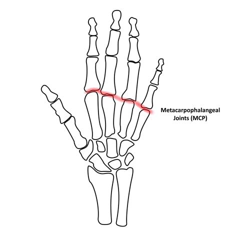 Metacarpophalangeal Joint Movement