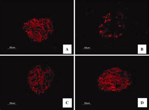 Immunofluorescence staining for nephrin. The representative fields show... | Download Scientific ...