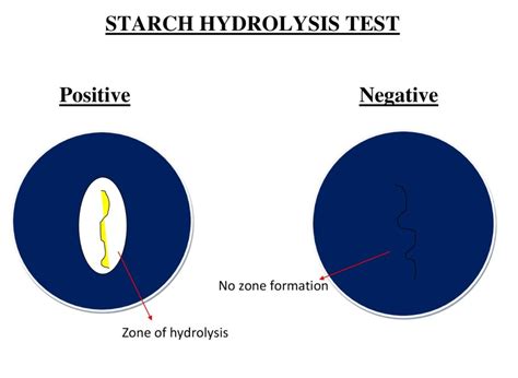 Gelatin hydrolysis test: principle and procedure - Online Biology Notes