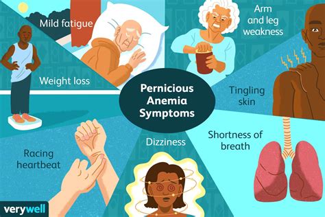 Pernicious Anemia: Symptoms, Causes, Diagnosis, and Treatment