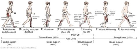 Please, Just STOP LIMPING! | Pediatric Emergency Playbook