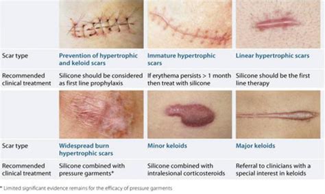 What are Scars? | Dermacare