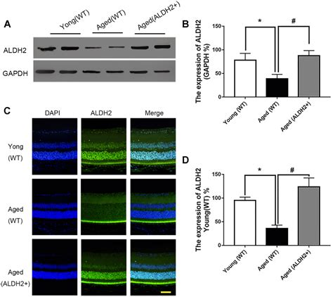 ALDH2 protects naturally aged mouse retina via inhibiting oxidative stress-related apoptosis and ...